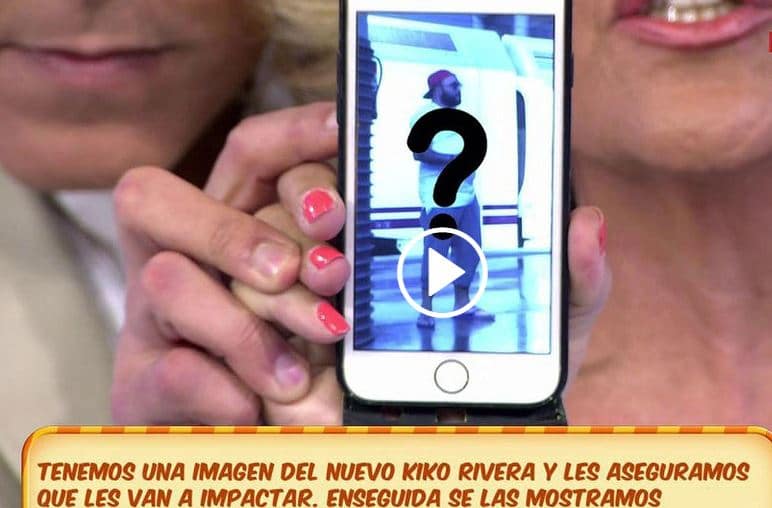 La reducción de estómago de Kiko Rivera