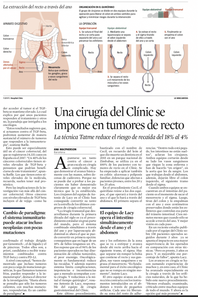 Cirugía del cáncer de colon