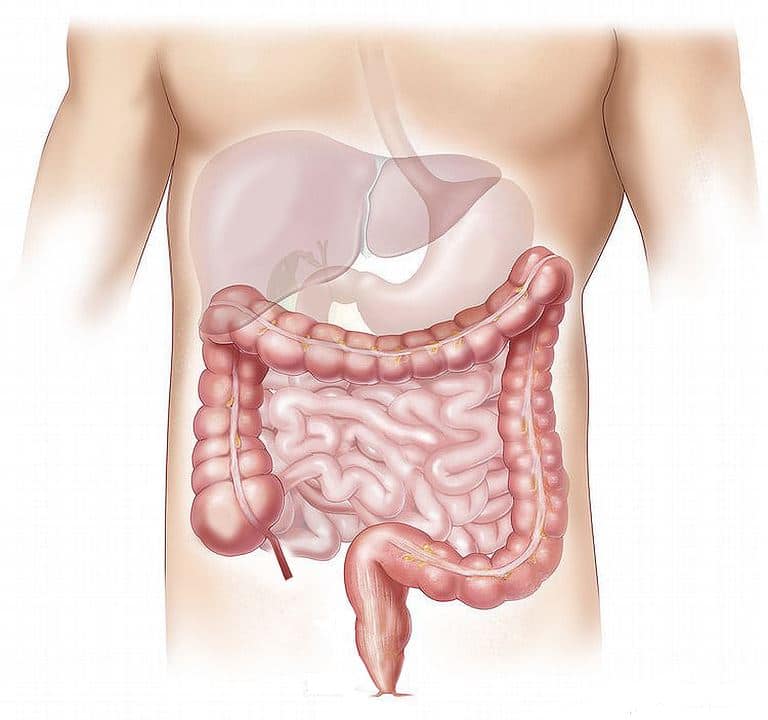 Enfermedad de Crohn. Intestino