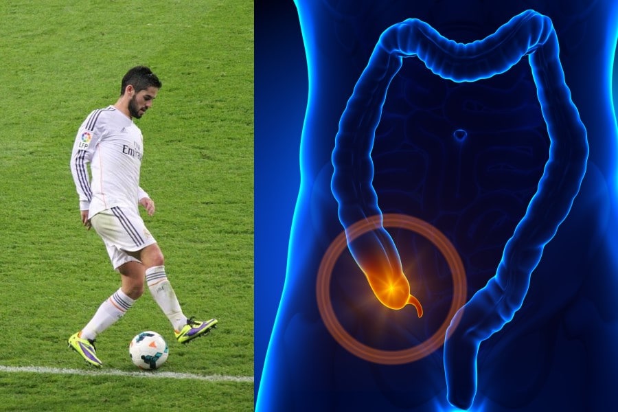 Isco Alarcón operado de apendicitis aguda