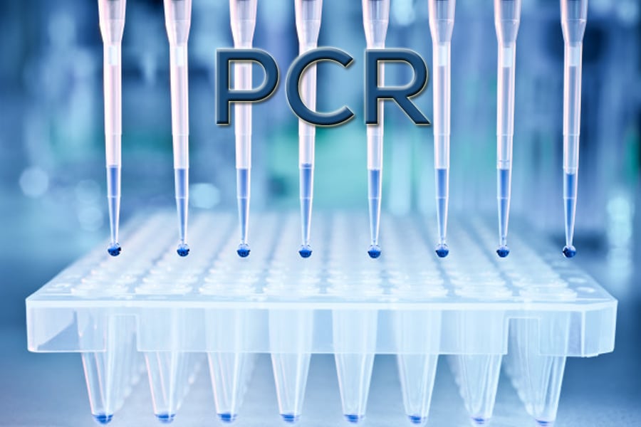 ¿Debería el Gobierno hacer test masivos a la población antes del desconfinamiento?